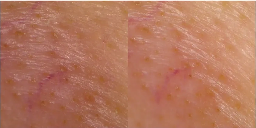 Очищення шкіри педами APOTHE Exosome Anti-Pollution Toning Pad