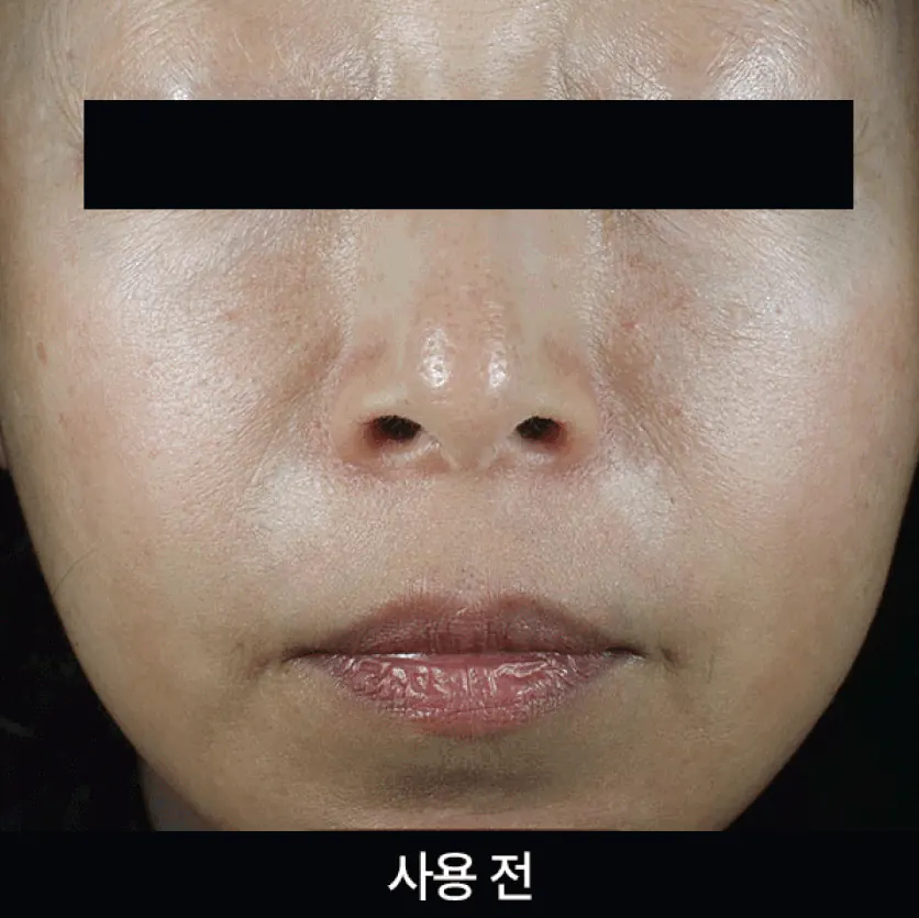 Ефект сяйва шкіри після сироватки APOTHE Exosome Mela-Glu Dark Spot Ampoule