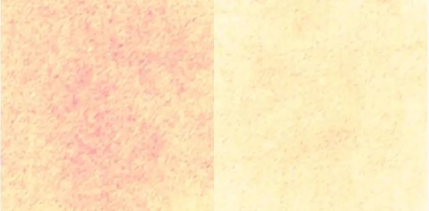 Успокаивающий эффект после крема APOTHE Exosome Squal-Tox Moisturizing Cream
