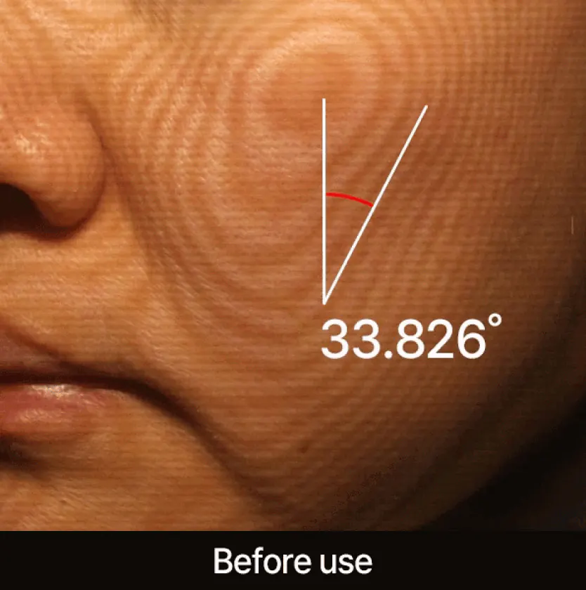 Лифтинг-эффект после маски APOTHE Red Capsule Pro-Collagen Lifting Mask