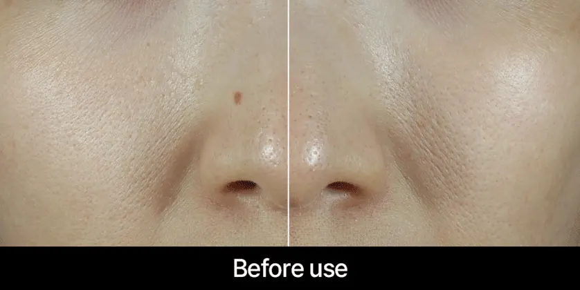 Эффект сияния кожи после маски APOTHE Rejuve Glow PDRN Collagen Wrapping Mask