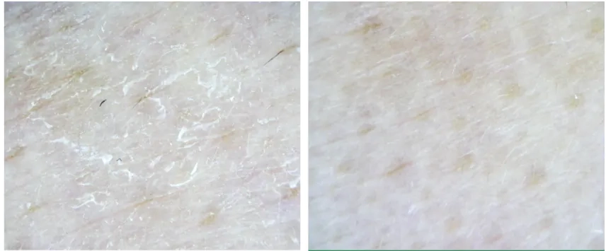 Видалення змертвілих клітин пілінгом AXIS-Y PHA Resurfacing Glow Peel