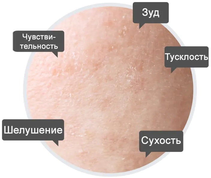 Проблемы, которые решает сыворотка Celimax Noni Energy Ampoule
