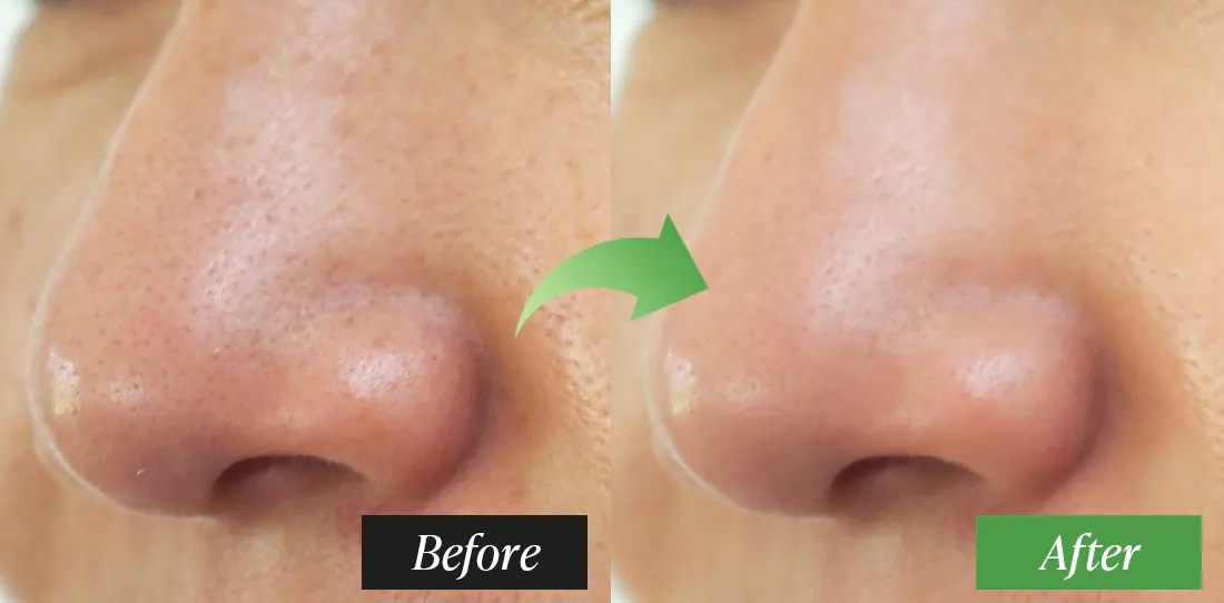 Результати використання Dr. Althea Premium Quick Step Sebum Cleanser
