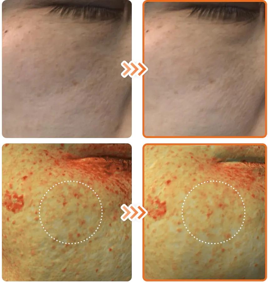 Зменьшення пігментації після сироватки Dr. Althea Vitamin C Boosting Serum