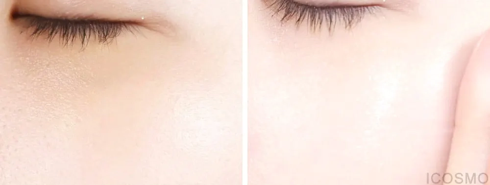 Кожа после нанесения крема Medi peel 5 Growth Factors Eye Tox Cream