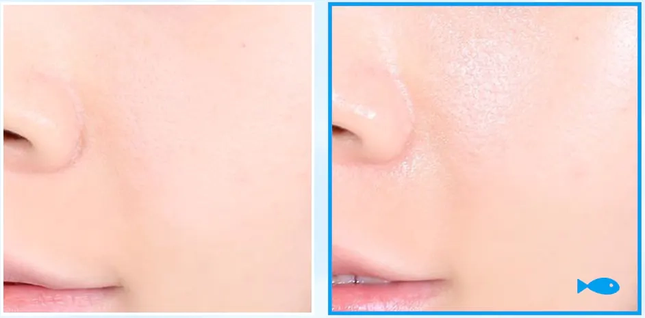 Кожа после крема Medi peel Mooltox PDRN Hyal Drop Gel Cream