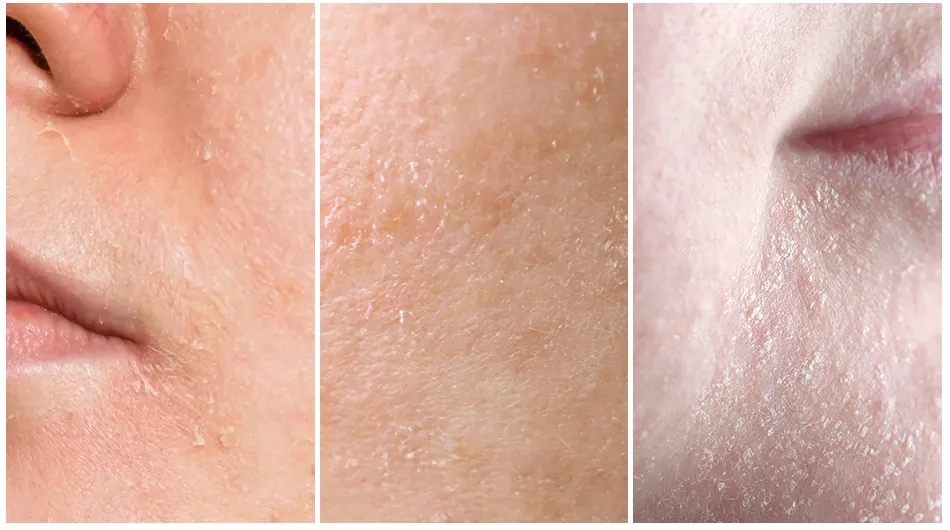 Для какой кожи подходит крем Medi peel Mooltox PDRN Hyal Drop Gel Cream