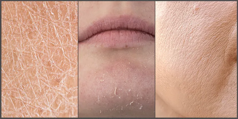 Для какой кожи подходит серия Medi peel Peptide 9 Aqua Essence