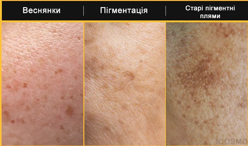 Проблеми шкіри які вирішує серія продуктів Medi Peel Peptide 9 Vitanol