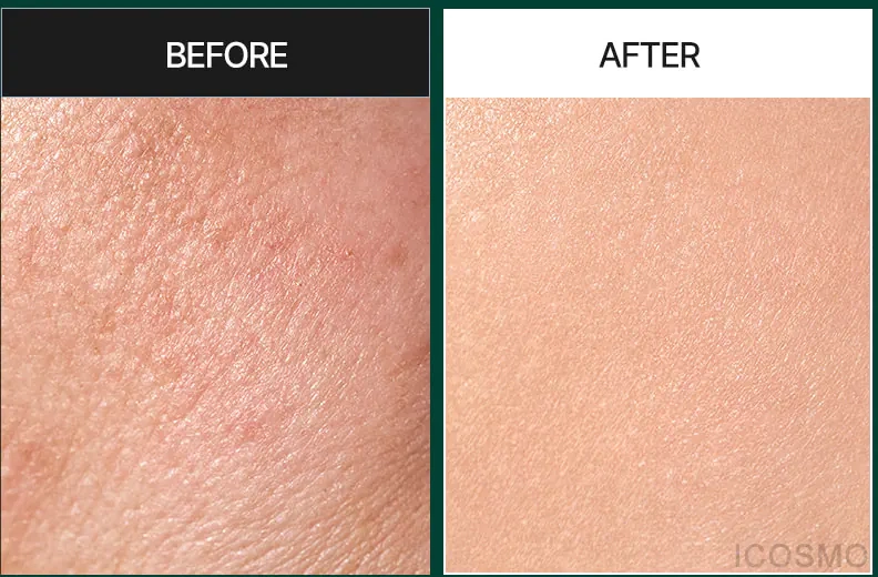 Шкіра після сироватки Medi peel Phyto Cica Nol B5 Shot