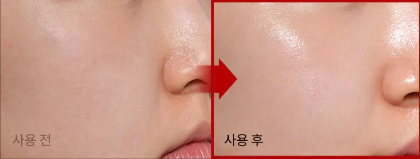 Еластичність шкіри після крему Medi peel Phyto Ex PDRN Lifting Shot Drop Gel Cream