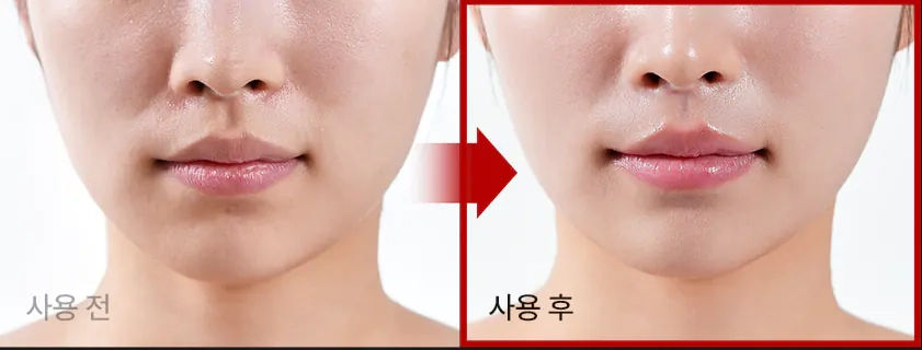 Ліфтинг-ефект крему Medi peel Phyto Ex PDRN Lifting Shot Drop Gel Cream