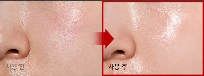 Сяйво шкіри після крему Medi peel Phyto Ex PDRN Lifting Shot Drop Gel Cream