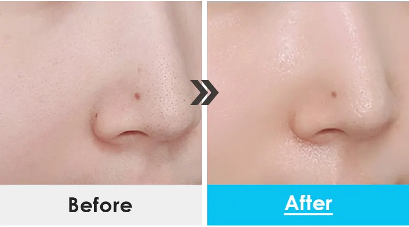 Кожа после нанесения крема Medi peel Power Aqua H8 Cream