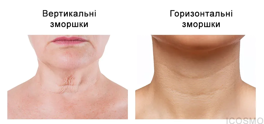 Для якої шкіри потрібен крем Medi Peel Premium Collagen Naite Thread Neck Cream 3.0