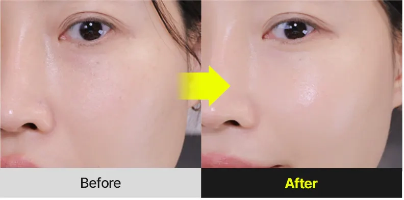 Результаты использования Medi peel Retinal NMN Bounce Shot Eye Cream