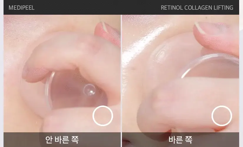 Пружність шкіри після використання серії засобів Medi Peel Retinol Collagen Lifting