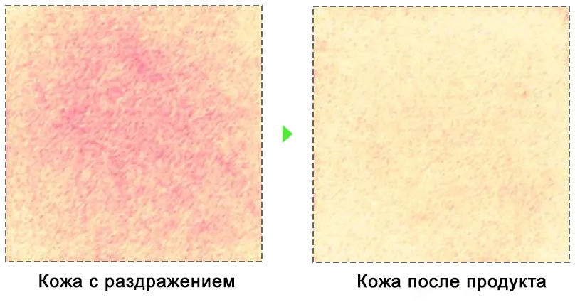 Успокаивающий эффект Medi peel Young Cica PDRN Trouble Soothing